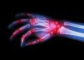 ketamine for pain